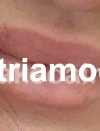 3534048573 - Alessia 40 Escort Terni